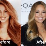 Mariah Carey Plastic Surgery Before and After Photos