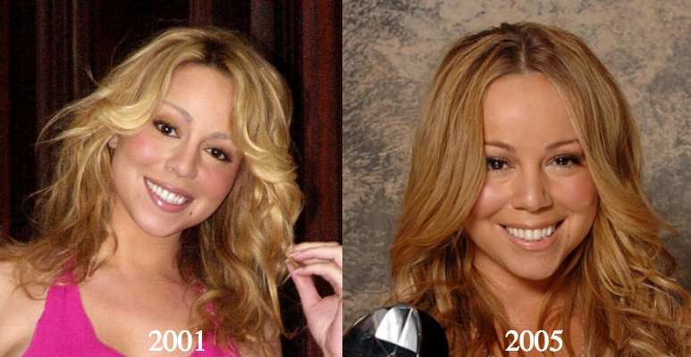 Mariah Carey plastic surgery 2001 2005