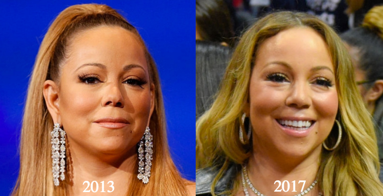 Mariah Carey plastic surgery 2017 2013