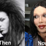 Pete Burns Plastic Surgery Before and After Photos