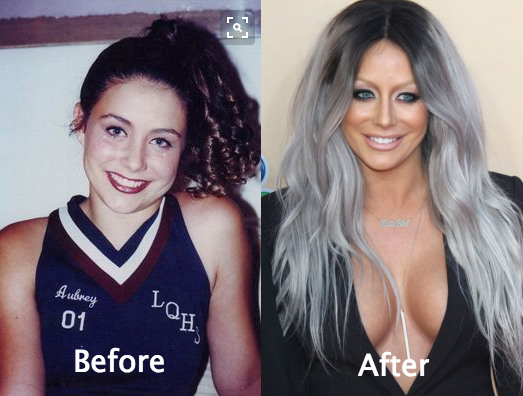 Do you see any cosmetic surgery differences in the photos of Aubrey O'Day?