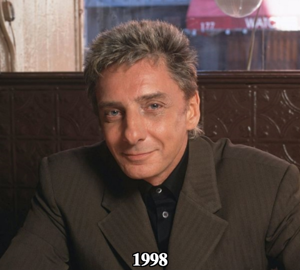 Barry Manilow after fillers botox 1998