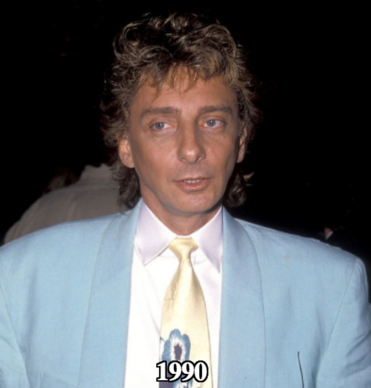 Barry Manilow before plastic surgery 1990