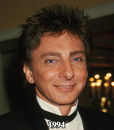 Barry Manilow start use of cheek fillers 1994