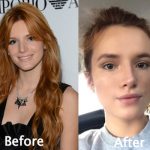 Bella Thorne Plastic Surgery Before and After Photos