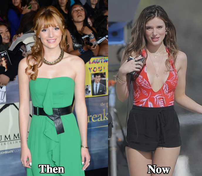 Bella Thorne boob job before and after photos