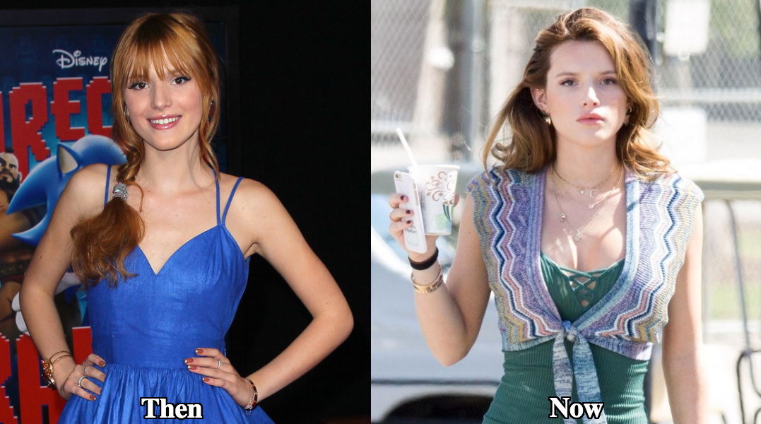 Bella Thorne breast implants before and after photos