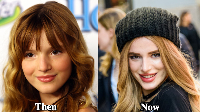 Bella Thorne nose job before and after photos