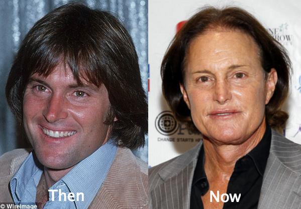 Bruce Jenner awful plastic surgery
