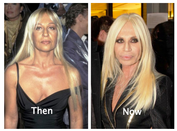 Plastic Surgery gone wrong