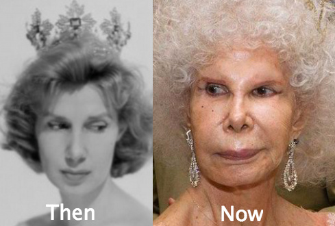 Duchess of Alba awful plastic surgery
