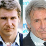 Harrison Ford Plastic Surgery Before and After Photos