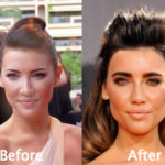 Jacqueline MacInnes Wood Plastic Surgery Before And After Photos
