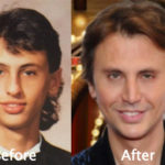 Jonathan Cheban Plastic Surgery Before and After Photos