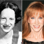 Kathy Griffin Plastic Surgery Before and After Photos