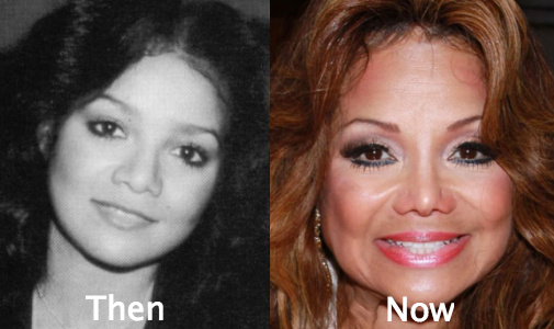 La Toya Jackson awful plastic surgery