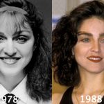 Madonna Plastic Surgery Before and After Photos