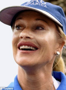 Melanie Griffith plastic surgery gone wrong