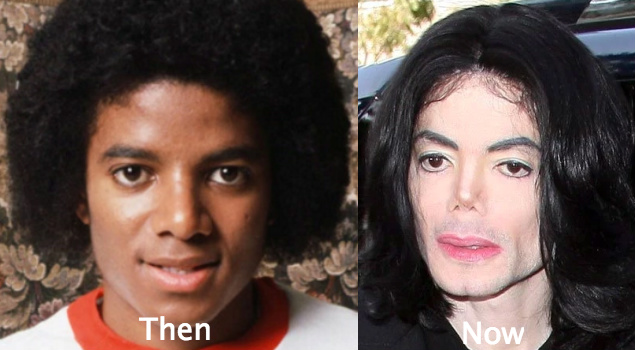 Michael Jackson awful plastic surgery