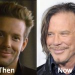 Mickey Rourke Plastic Surgery Before and After Photos