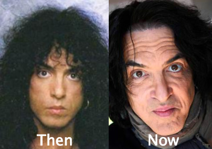Paul Stanley Awful Plastic Surgery