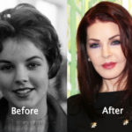 Priscilla Presley Plastic Surgery Disaster Before After Photos