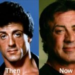 Sylvester Stallone Plastic Surgery Before and After Photos