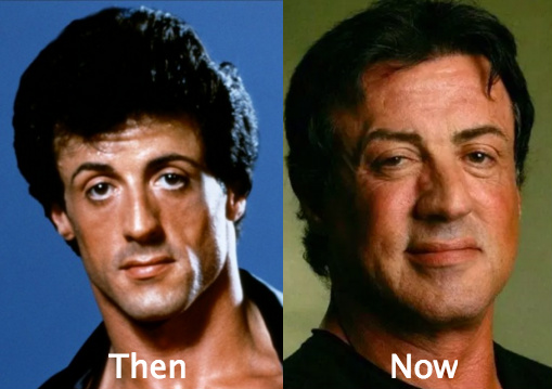 Sylvester Stallone Cosmetic Surgery Rumors