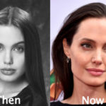 Angelina Jolie Plastic Surgery Before and After Photos