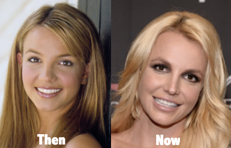 What Plastic Surgeries did Britney Spears Undergo