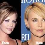 Charlize Theron Plastic Surgery Before and After Photos