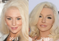 Courtney Stodden Plastic Surgery Before and After Photos