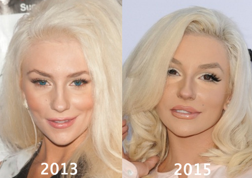 Courtney Stodden is open about her cosmetic surgeries