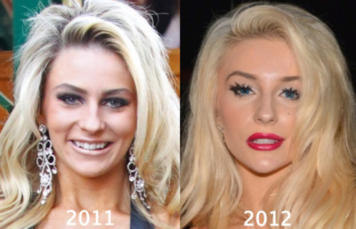 Courtney Stodden Plastic Surgery Before and After Photos
