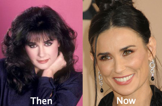 Demi Moore nose looks different