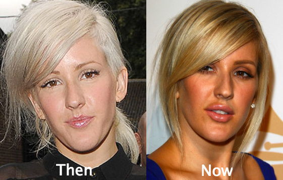 Ellie Goulding looks very different a few years ago