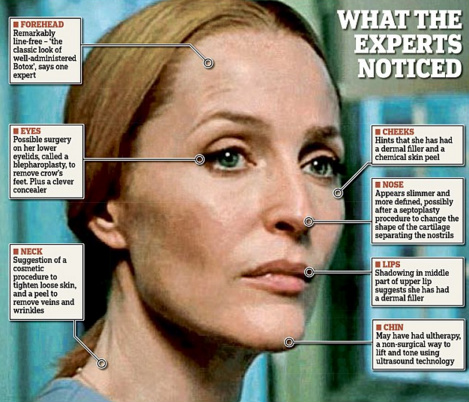 Gillian Anderson plastic surgery speculations