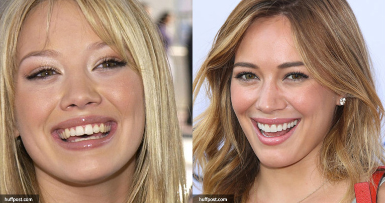 Hilary Duff has the perfect smile now