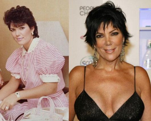 Kris Jenner had breast augmentation years ago