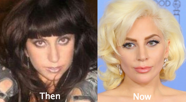 Gaga Definitely Had A Nosejob Page 3 Gaga Thoughts Gaga Daily