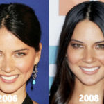 Olivia Munn Plastic Surgery Before and After Photos