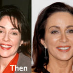 Patricia Heaton Plastic Surgery Before and After Photos
