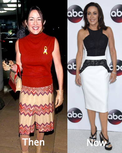 Patricia Heaton went for breast reduction surgery after childbirth