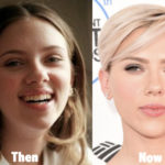Scarlett Johansson Nose Job Plastic Surgery Before and After