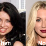 Stassi Schroeder Plastic Surgery Before and After Photos