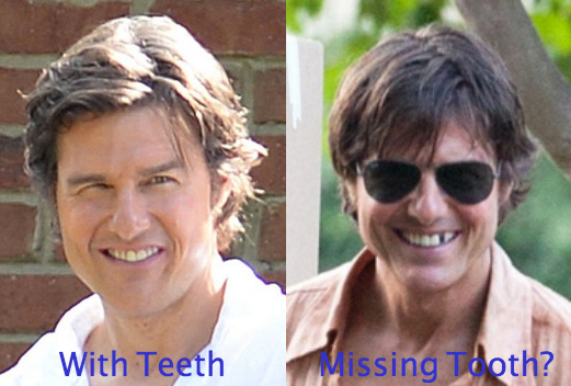 Tom Cruise Removes front tooth for movie role