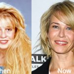 Chelsea Handler Plastic Surgery Before and After Photos