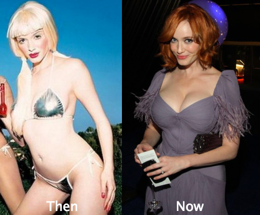 Christina Hendricks Plastic Surgery Before and After Photos