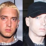 Eminem Plastic Surgery Before and After Photos