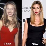 Ivanka Trump Plastic Surgery Before and After Photos
